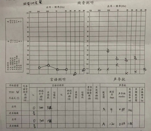 初中时不幸失聪!18年后小伙重获 “新”声,这项先进技术立了功!